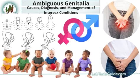 Category : Intersex medical images